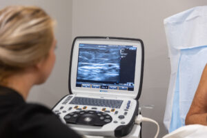 A provider monitors an ultrasound monitor while she performs Varithena for vein disease treatment in Sebring.